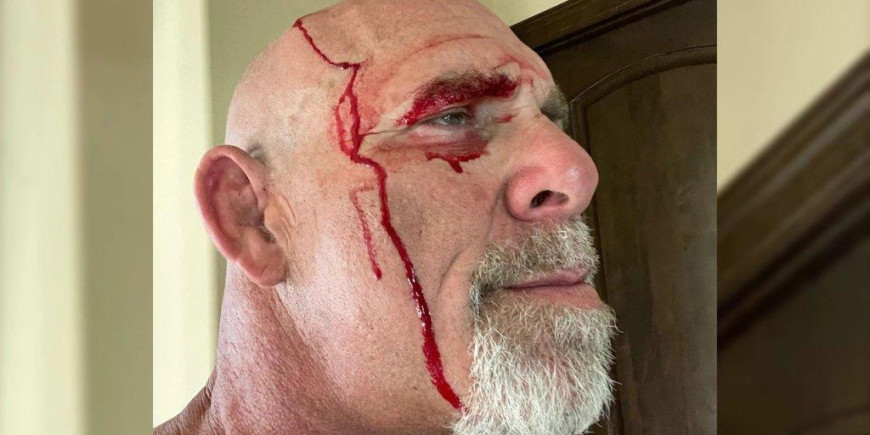 Goldberg Gets Busted Open In Tractor Accident